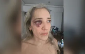 Passageira é agredida por motociclista de aplicativo após desistir da corrida