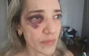 Passageira é agredida por motociclista de aplicativo após desistir da corrida