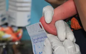 São Gonçalo reforça importância do teste do pezinho em recém-nascidos