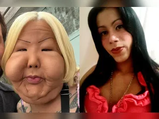 Quem é 'Juju do Pix', influenciadora que passou por cirurgia para retirar óleo mineral do rosto