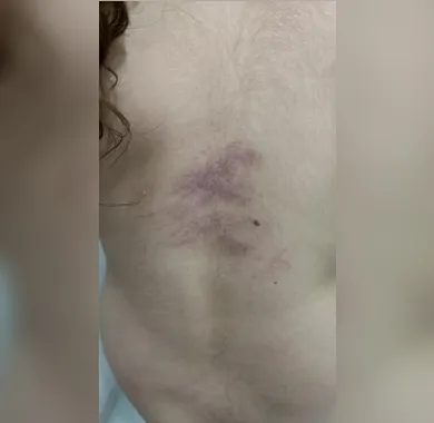 Dor e luta de uma mãe atípica: denúncia de agressão a menina autista em São Gonçalo levanta alerta sobre terapias sem preparo