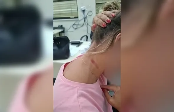 Mulher é agredida por ex-marido policial civil em Niterói
