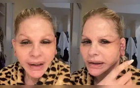 Monique Evans alega que banco não reconheceu seu rosto após cirurgia plástica