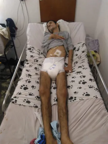 Márcio tem 35 anos e possui neurossífilis, uma variante da sífilis, uma doença sexualmente transmissível