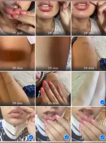 Pamella mostra que ficou cheia de machucados pelo corpo após agressões do cantor