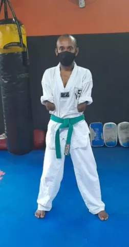 Marcio sofreu um amputação quando ainda era novo  