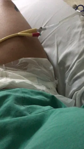 Em alguns momentos, o xixi na fralda e na sonda vazavam