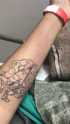 No HEAT, a jovem afirmou que passavam na sua pele um medicamento que dava irritação