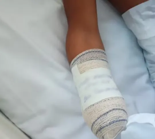 A criança de 8 anos perdeu a mão direita e dedos do pé após explosão de artefato