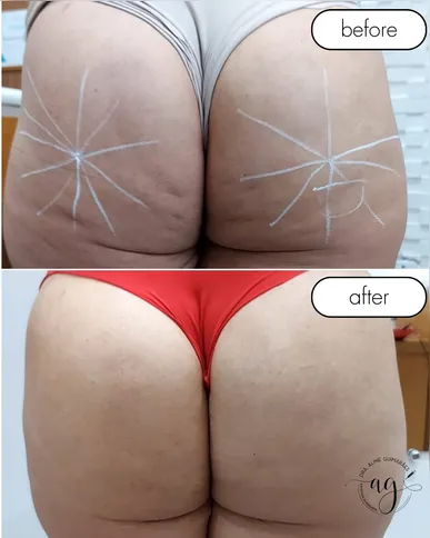 Mulheres comuns confirmam os efeitos positivos da harmonização, que aumenta a confiança para usar roupas justas e biquínis