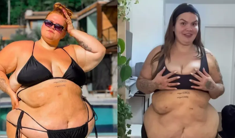Thais Carla mostra o corpo depois de perder 72 kg devido bariátrica