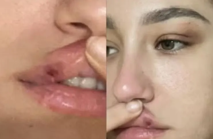 MC Estudante é réu em um processo de agressão contra a ex-namorada, Maria Eduarda Paim