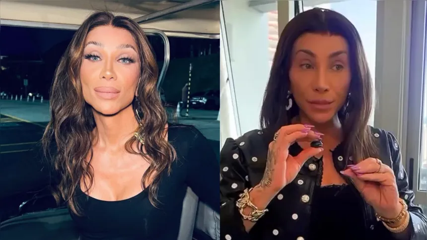 Maya Massafera mostrou o antes e depois de sua cirurgia no rosto