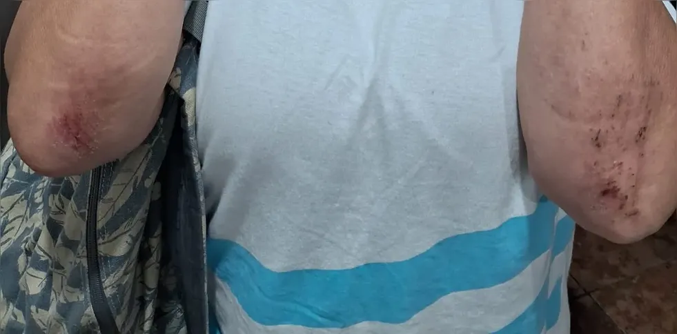 Vítima acabou ferida na tentativa de fuga