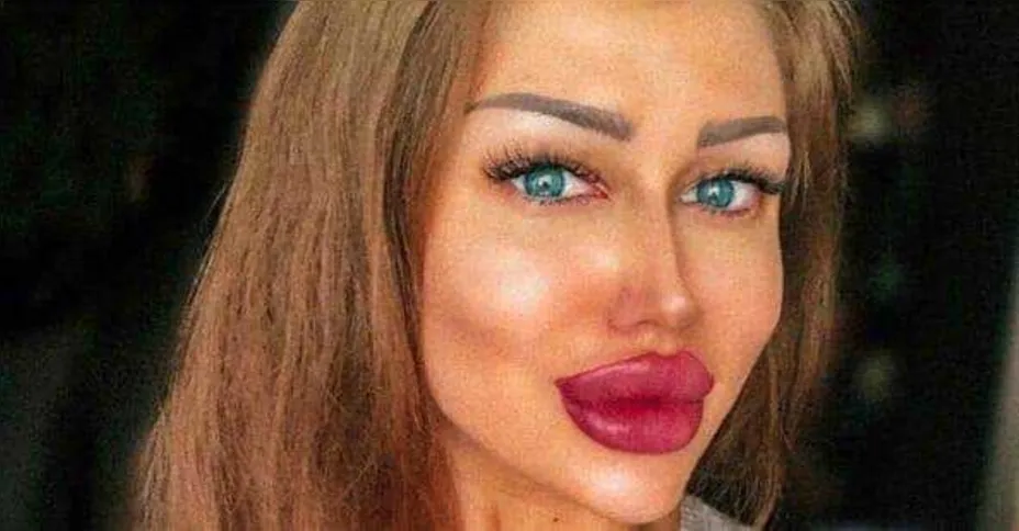Imagem ilustrativa da imagem Jovem russa fã de Kim Kardashian 'abala' a internet com mudança radical
