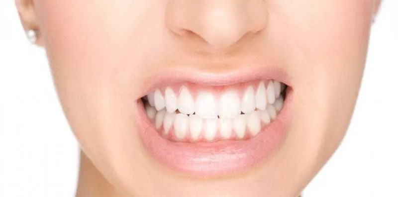 O problema é caracterizado pelo hábito de ranger ou apertar muito os dentes e ocorre, de forma involuntária, durante o sono

