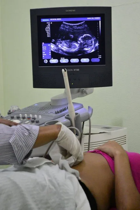 Para agendar, paciente devem apresentar pedido médico do SUS 