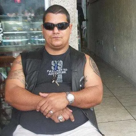 Cirne se acidentou em buraco