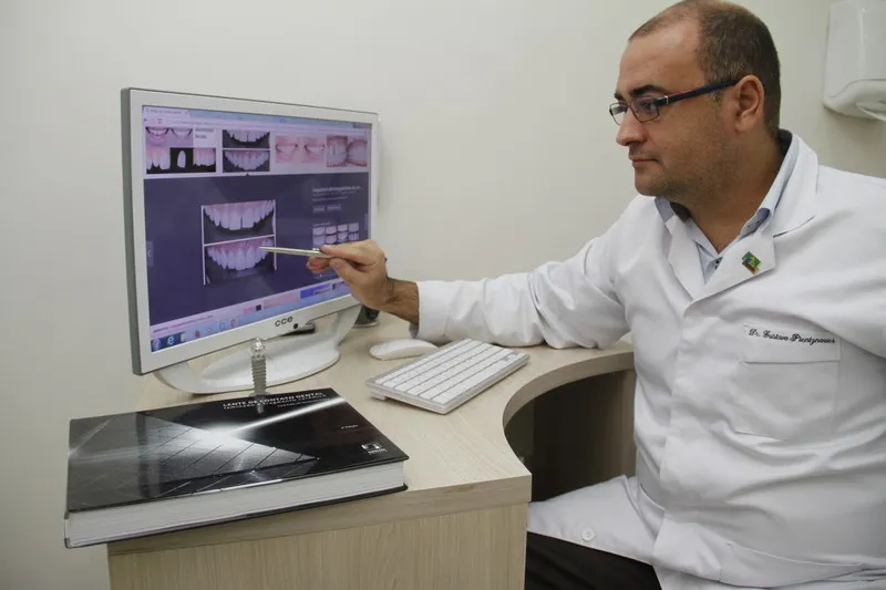 Imagem ilustrativa da imagem Lentes de contato para um sorriso perfeito