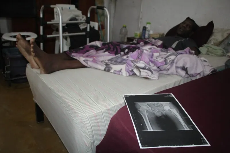 Imagem ilustrativa da imagem Gonçalense aguarda há dois anos, na cama, por cirurgia na perna