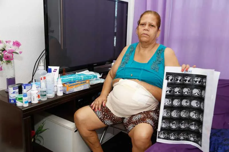 Sônia mostra foto de sua barriga antes de fazer operação