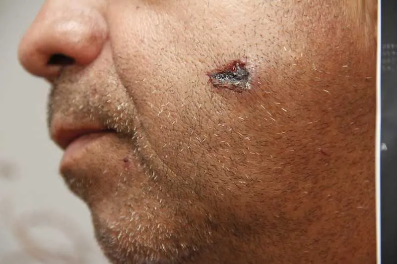 Imagem ilustrativa da imagem Deus colocou a mão na frente e me salvou", diz taxista baleado em Niterói