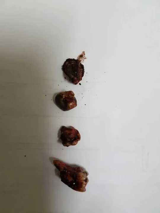 Dentes achados na cena do crime eram objetos de ritual de magia negra
