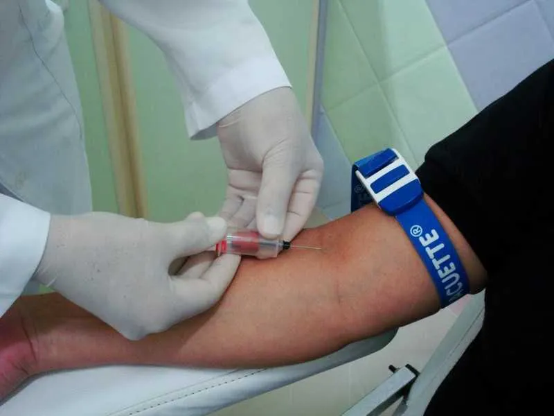 De acordo com a orientação, a obrigatoriedade de jejum deverá ser avaliada pelo médico