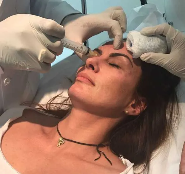 Vaidosa, Núbia Óliiver voltou a aplicar botox na última sexta-feira, 10. A modelo de 43 anos, que já declarou ser totalmente dependente do método de beleza, realiza o procedimento há anos. "Hoje foi dia de renovação do botox e todos sabem que isso para mim é igual bolsa de mulher, não vivo sem! Um botox levanta a moral de qualquer mulher", declarou ela a imprensa.