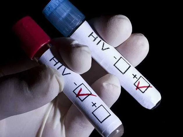 Imagem ilustrativa da imagem Cientistas dão passo gigante ao eliminar HIV do organismo de animais vivos