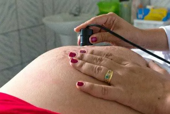 Médicos condenam o uso de bebidas alcoólicas por gestantes. Bebês podem sofrer danos irreversíveis como retardo mental e anomalias congênitas    