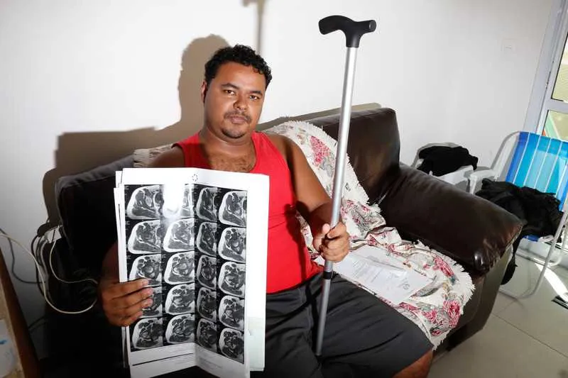 Rafael dos Santos precisa de cirurgia para acabar com dificuldades de andar e sentir as dores