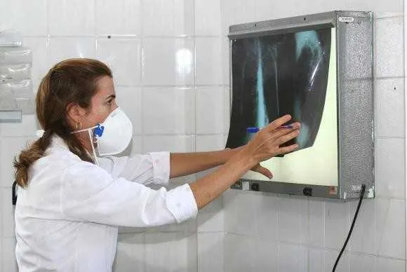 Levantamento destaca a necessidade de os governos aumentarem os esforços de combate à tuberculose que, em 2015, matou 1,8 milhão de pessoas no mundo