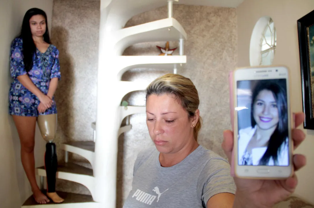 Thaynara perdeu a perna esquerda na colisão e Aline perdeu a filha Letícia, que tinha 21 anos