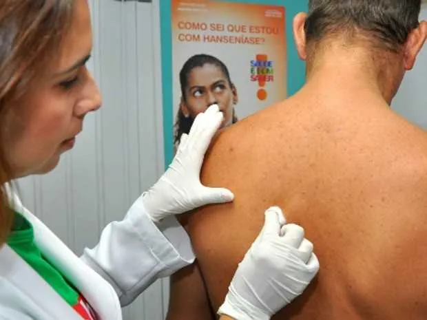 Objetivo é acolher pacientes, esclarecer dúvidas sobre meios de transmissão e tratamento