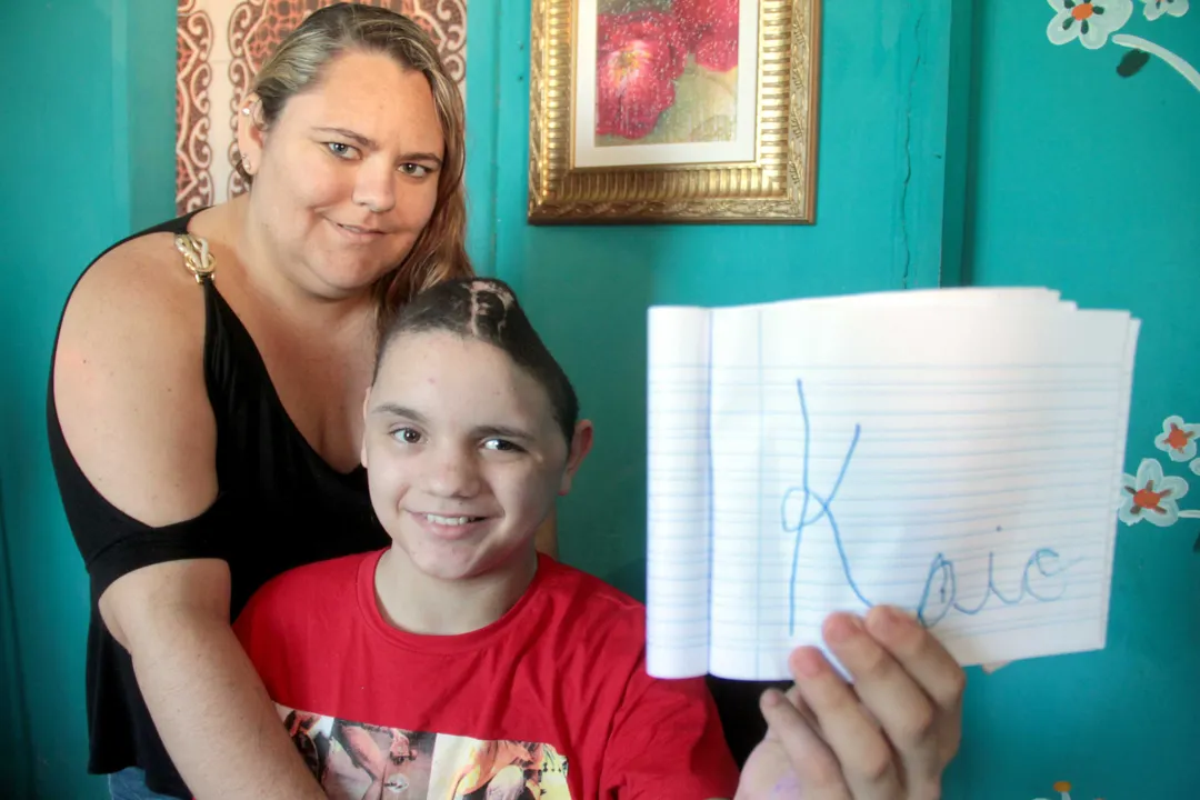 Imagem ilustrativa da imagem Kaio se recupera bem de cirurgia para colocação da calota craniana