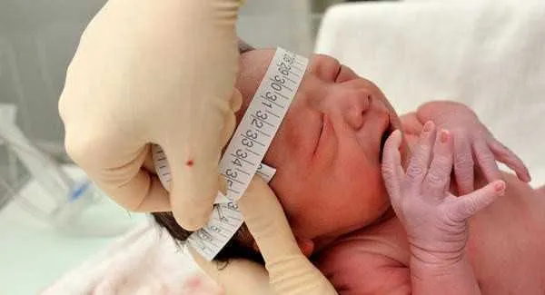 Imagem ilustrativa da imagem SUS terá medicamento para convulsões em pacientes com microcefalia