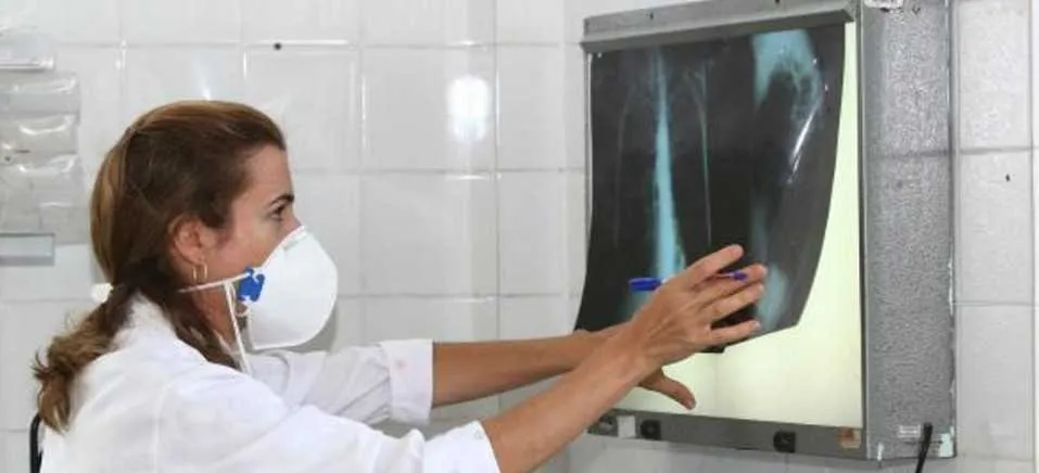  Profissionais serão orientados sobre estratégias para auxiliar pessoas em tratamento da tuberculose