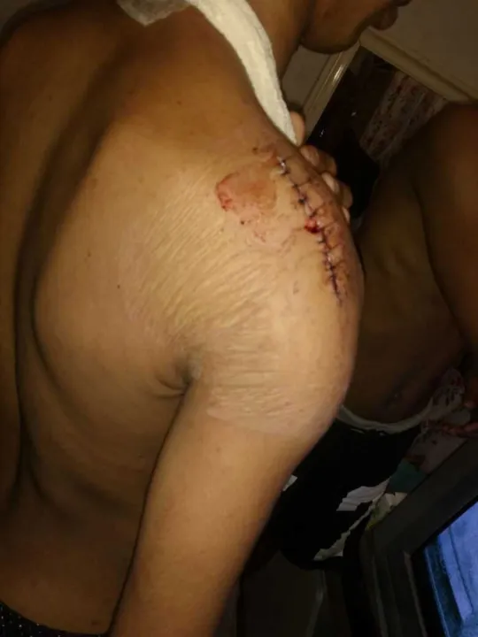 Drag queen é agredida em São Gonçalo