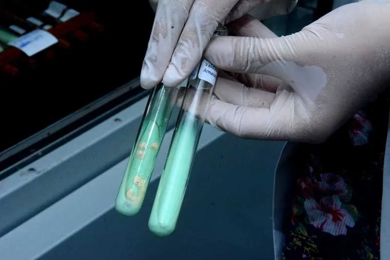 Exames para o diagnóstico da tuberculose são entregues em um dia para início do tratamento