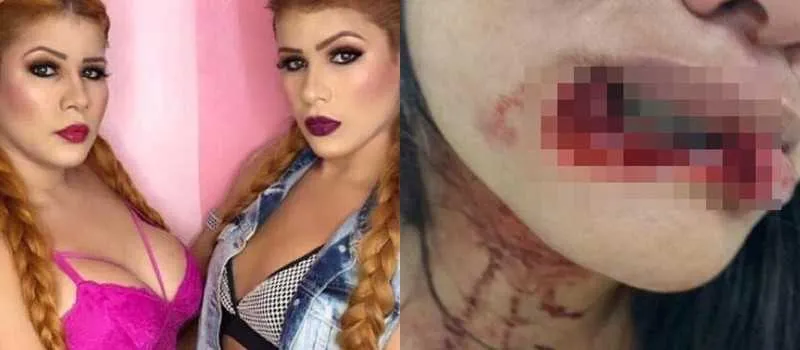 Caso aconteceu em Manaus, na quinta-feira (14)