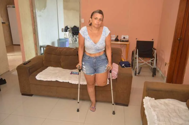 Estudante de direito viu a vida virar do avesso após acidente