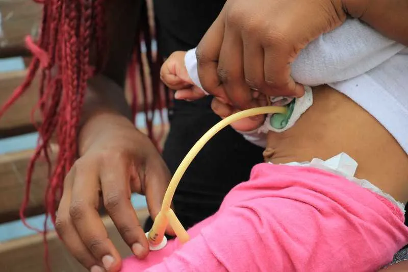 Menina de 2 anos tem microcefalia e usa uma sonda gástrica