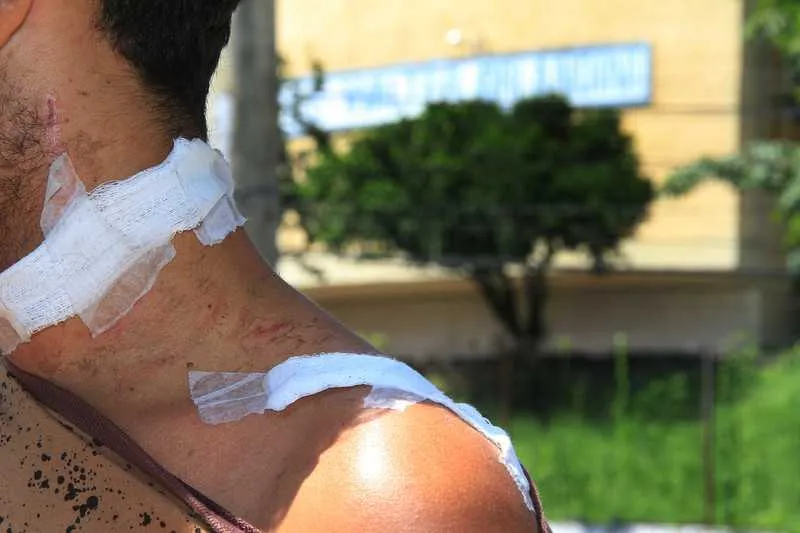  Estudante foi baleado no pescoço durante assalto na saída da escola. Ontem, ele voltou ao local do crime