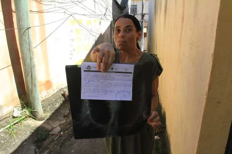 Imagem ilustrativa da imagem Moradora de SG espera dois anos por uma cirurgia