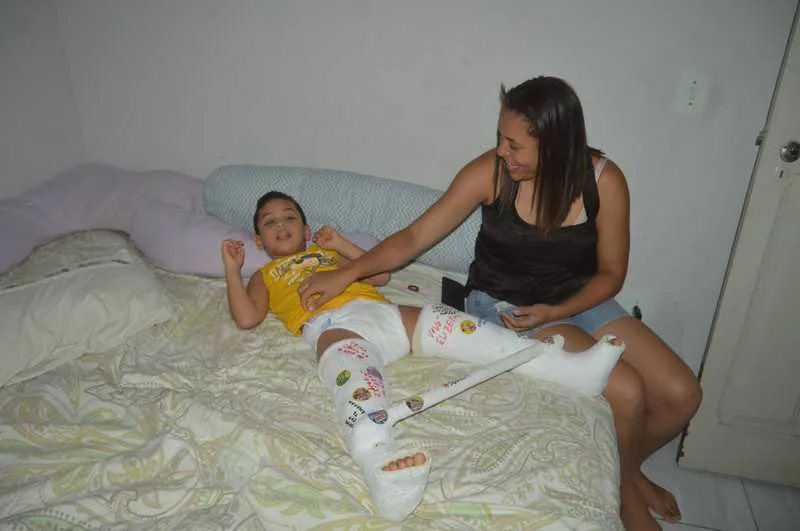 Delicada cirurgia chamada rizotomia dorsal seletiva só é realizada em hospital americano