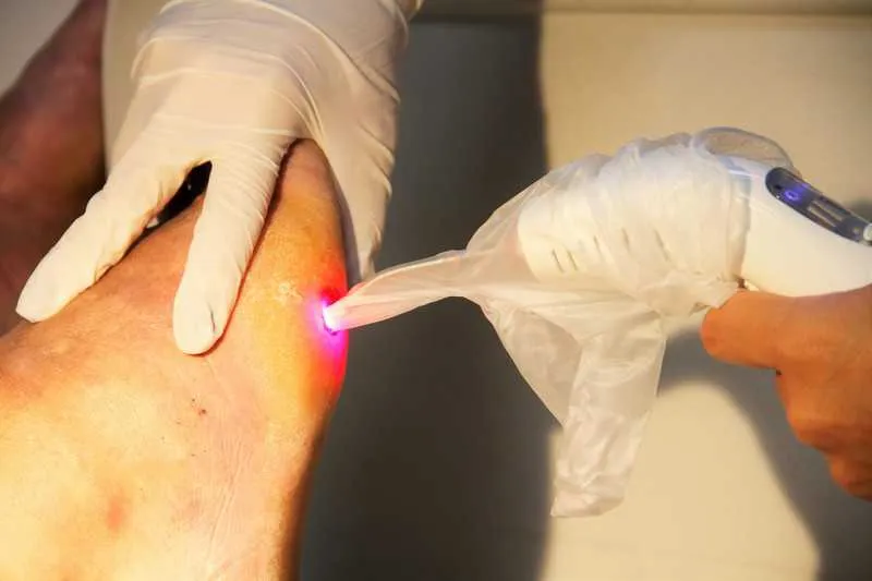 Imagem ilustrativa da imagem Prefeitura de São Gonçalo oferece tratamento dermatológico para idosos