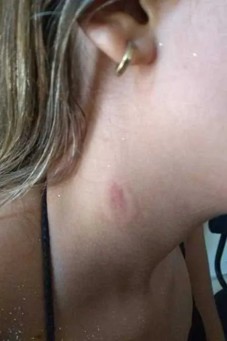 Adolescente foi agredida após recusar beijo