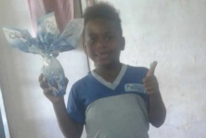 Menino teve 60% do corpo queimado 