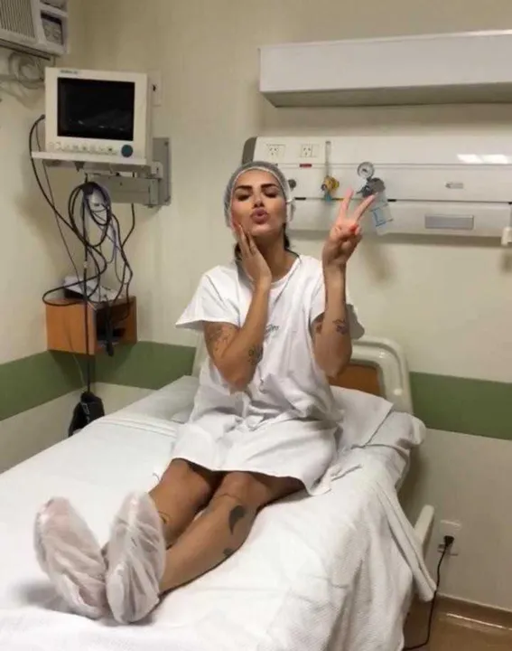 Musa diminuiu prótese de 390ml para 350ml